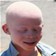 Albinismus - Bilder